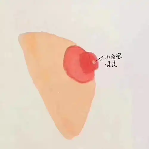 哺乳期涨奶有硬块,应该怎么解决?