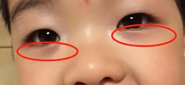 宝宝眼袋发紫,发黑,脾虚已久!健脾胃的"冠军王"食物是什么