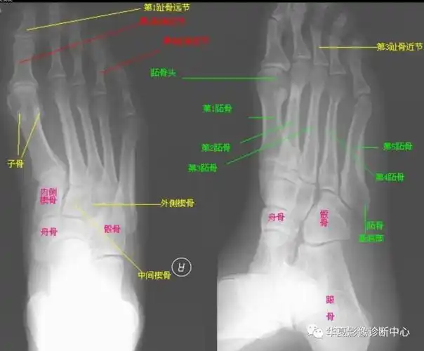 影像记忆口诀集绵图文总结版二
