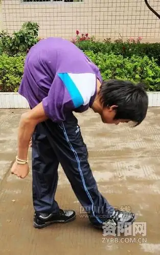 凉山驼背小伙儿站直了 想在资阳扎根