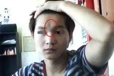 面相说 |"印堂"命运的总开关,能影响整体运势_网易订阅