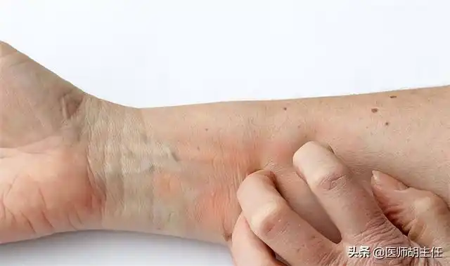 胆管癌来袭并非悄无声息这3个部位出现异常建议尽早检查