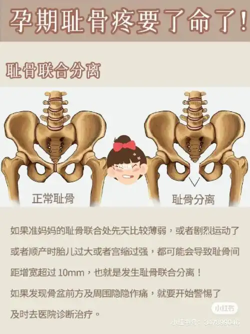 34耻骨疼那真要命