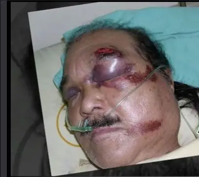 发音不准引纠纷 日老翁险被台出租车司机殴打致死