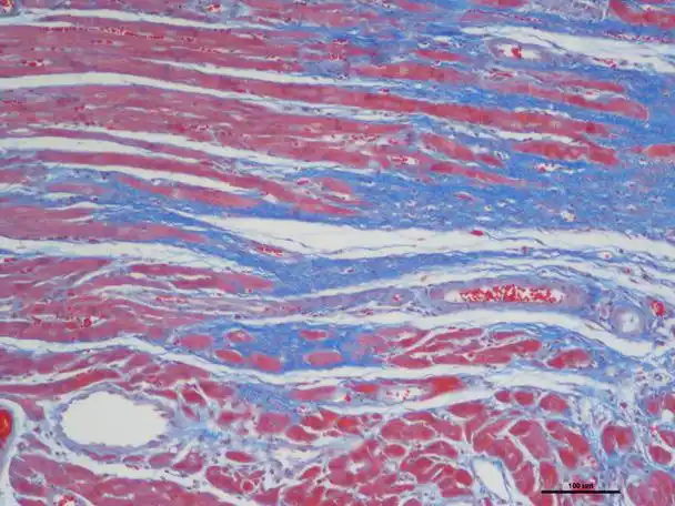 masson染色_病理染色_北京晶莱华科生物技术有限公司