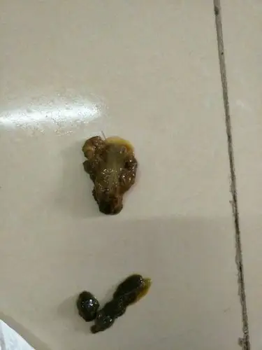 狗狗现在拉了这样的便便,请问是什么问题呀