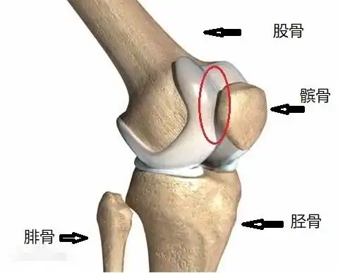 髌骨软化的原因,离不开3大诱因,不少人还在犯