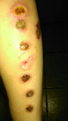 我该不该告他故意伤害罪.