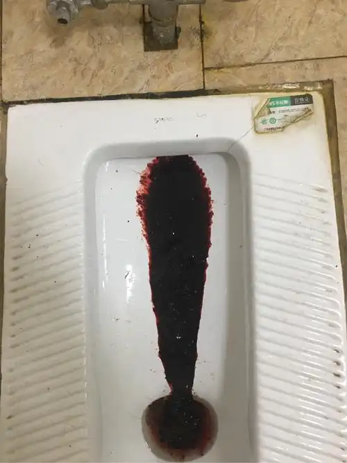 这样的大便是小肠淋巴癌