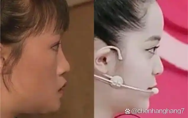 为什么你的侧脸不好看?问题在于哪里?如何改善呢.