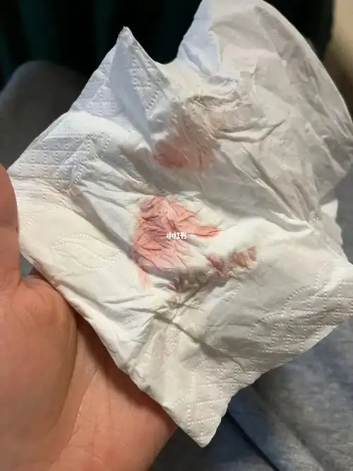 移植第二十天出血了