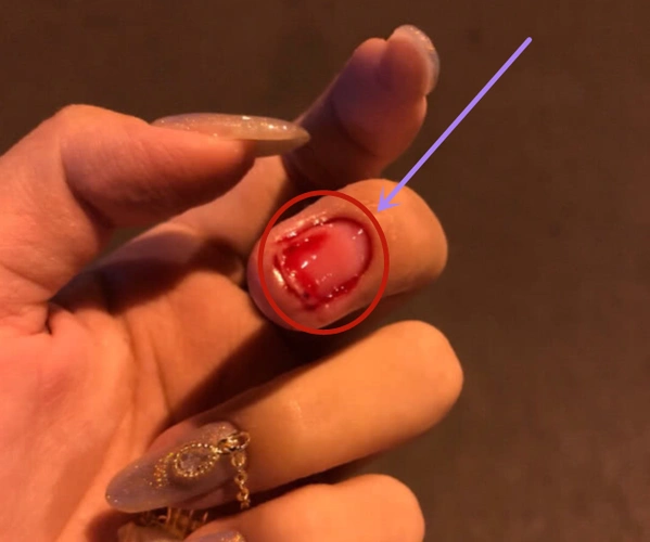 女生千万别轻易尝试链条美甲,如果出现触电或者指甲脱落,后悔也晚了!