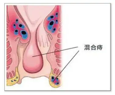 广州东大肛肠医院好不好,专业精准治疗各种肛肠疾病