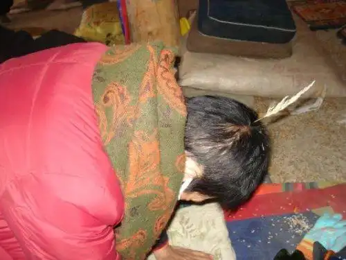 罕见的破瓦法开顶照片