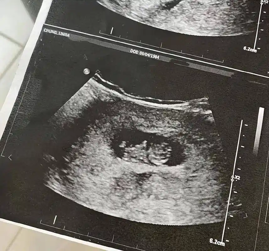 38岁女星钟嘉欣官宣三胎穿紧身衣小腹隆起明显晒三胎b超照