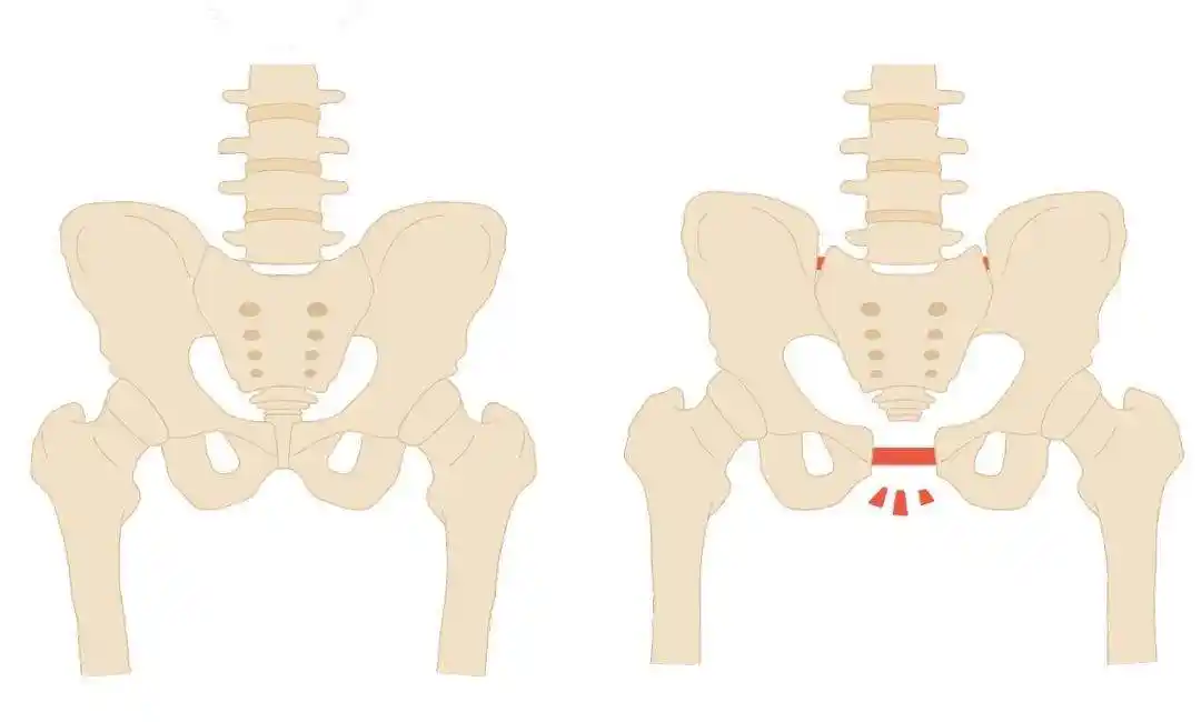 "一孕傻三年"是真的?张歆艺生娃后忘性大,产后4点变化很明显