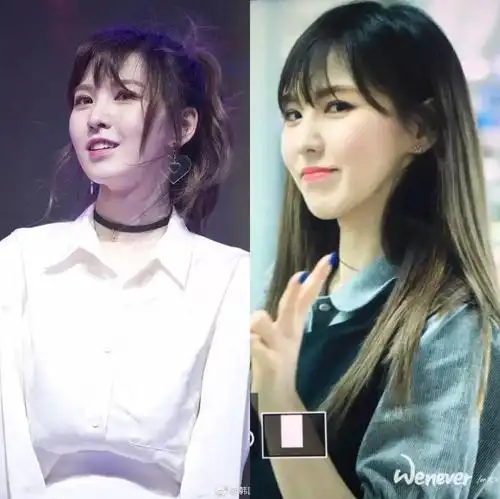 红毛的wendy,下颌骨似乎离家出走惹?