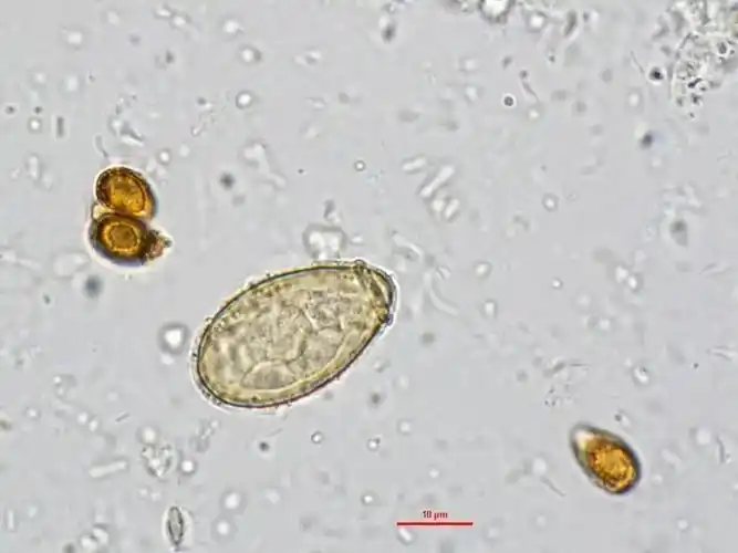 专家专栏肝吸虫卵vs灵芝孢子你还傻傻的分不清吗