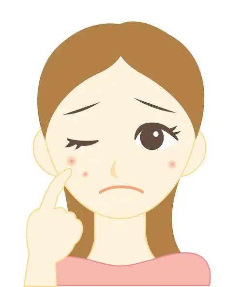 1,为什么会长痘?