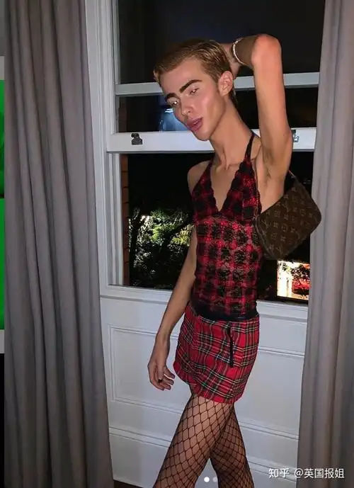 英国年轻男星暴瘦脱相四肢如竹竿超恐怖网友关心反被骂