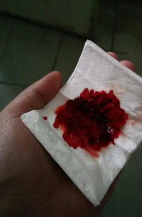 今早吐血了,这事肿么了?