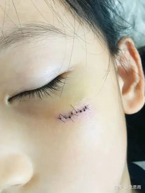 真的对滑板有阴影了,尤其是每天早上起来照镜子,都能看到脸上的疤,真