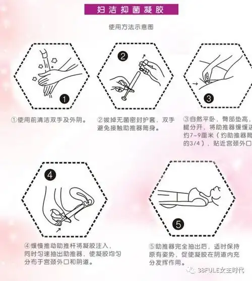常见问题一,三八妇乐抑菌凝胶怎么用?