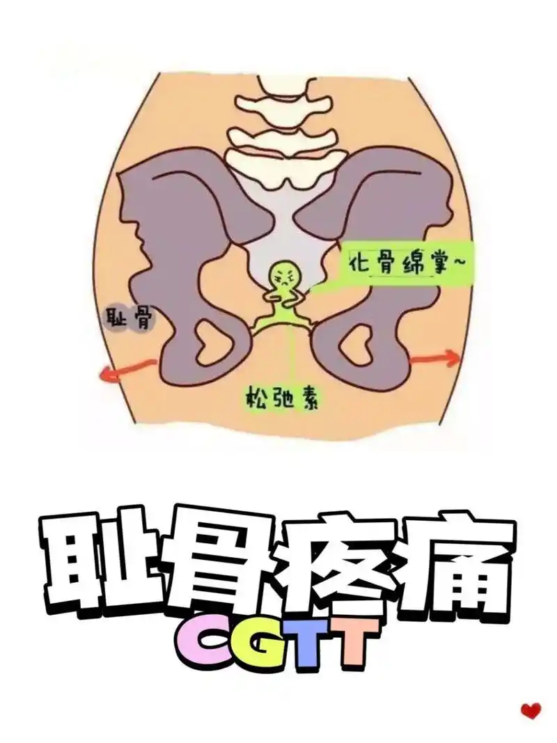 孕期日常→耻骨疼痛,如何缓解  怀孕,真的是个很辛苦的过程.