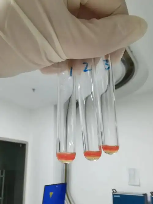 骨髓瘤处理策略(附案例分享)|患者|多发性|骨髓瘤|血型|试管|-健康界