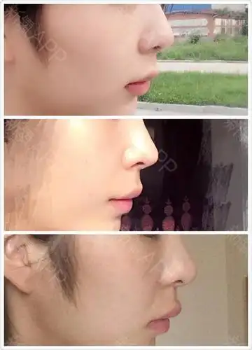 对比图只有中间是手术后.其余上下都不是.