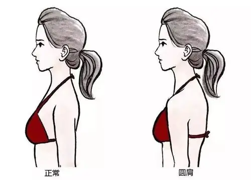 这样做告别"大妈感",1秒显瘦10斤~|骨盆|胸部下垂_新浪新闻