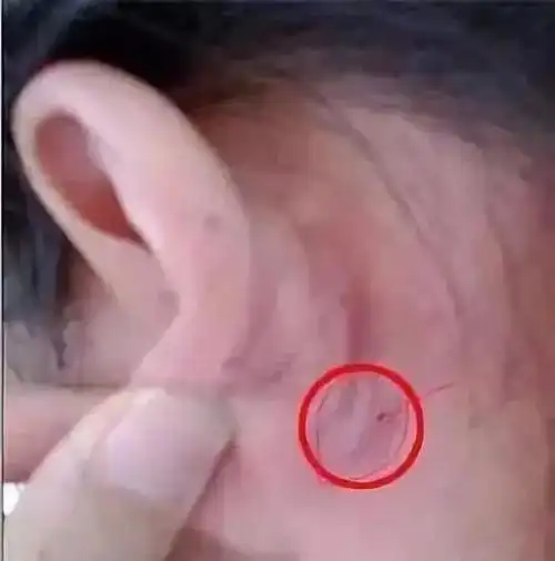 耳后一个窝专门降糖调血每天按10秒钟效果很神奇