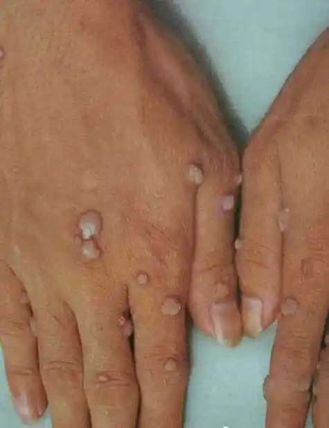 看图片识别皮肤病(看图片识别皮肤病图片)