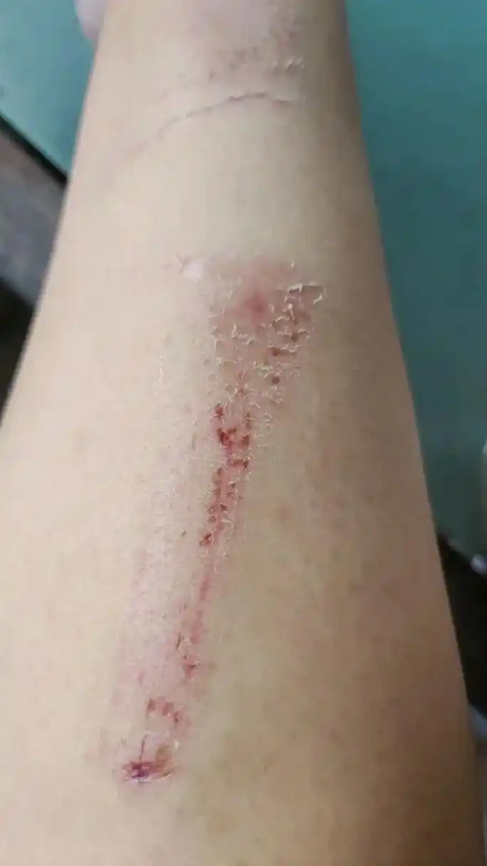 为什么受伤的总是我 一年一次腰疼,疼的我想死的心都有