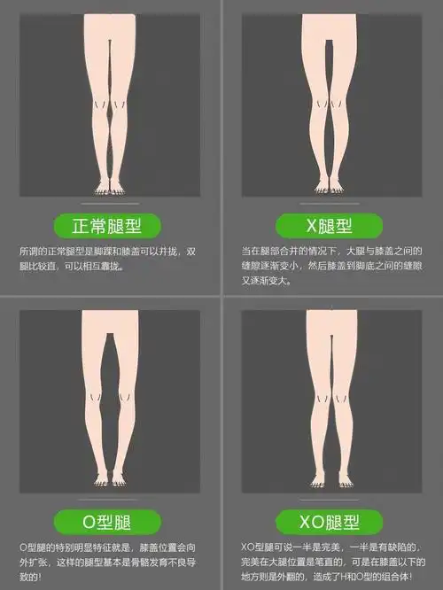 20秒自测你属于哪种腿型如何快速矫正