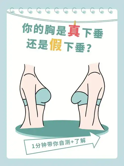 1分钟教你判断胸部下垂真假60