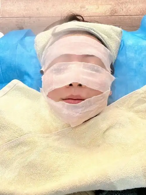 以色列美迪迈黄金微针78    这个仪器除了做微针 还有一个射频的头