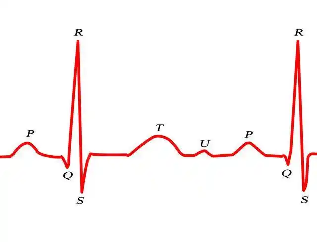 正常心电图的波形特点及正常值一次给你说清楚