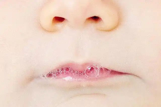 比方说,唾液中含有一种"免疫球蛋白",正常人这种蛋白含量是比较稳定的