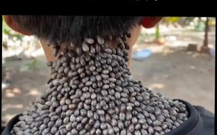 小男孩调皮,粘了很多小东西.密集恐惧症者勿进_哔哩哔哩_bilibili