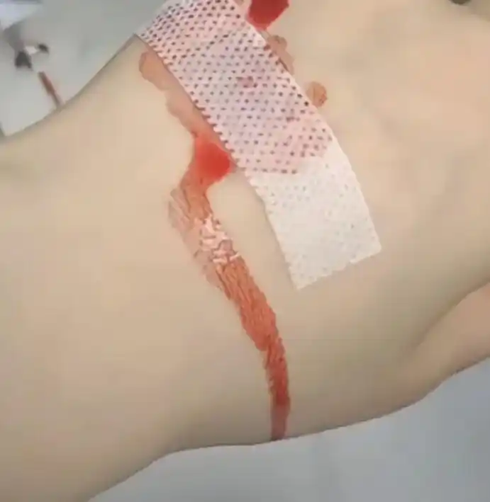 孤独大概就是自己生病,一个人去输液,自己守着吊瓶,困了不敢睡 - 抖音