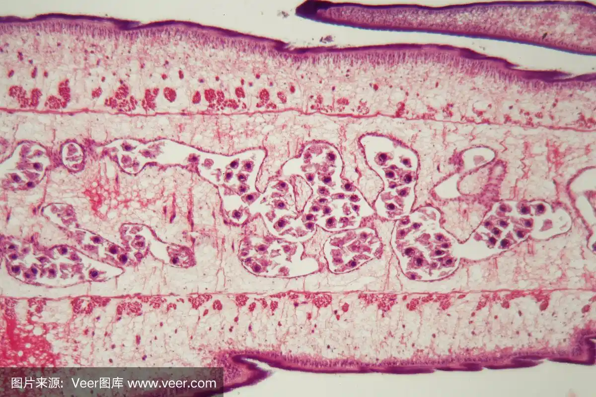 绦虫体的一部分(节片)