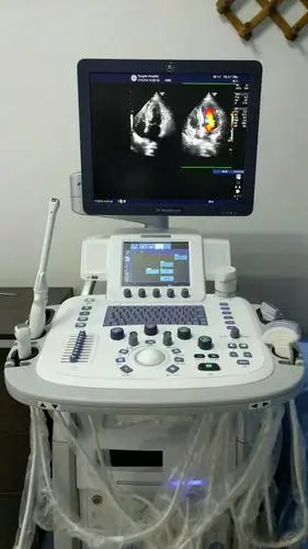 同安医院心脏彩超正式启用