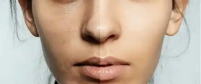 皮肤粗糙,没有光泽,是皮肤缺水了吗?