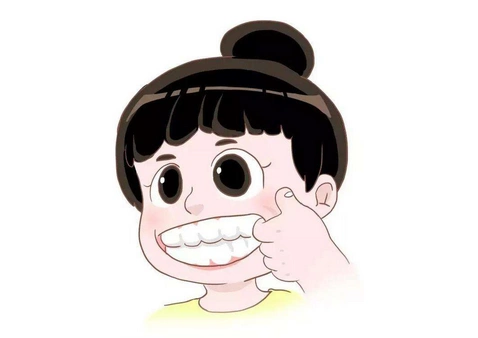 隐形牙套效果图片7