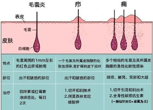 它的病因及诊治_毛囊炎_发病原因_症状表现_如何预防_检查_治疗方式