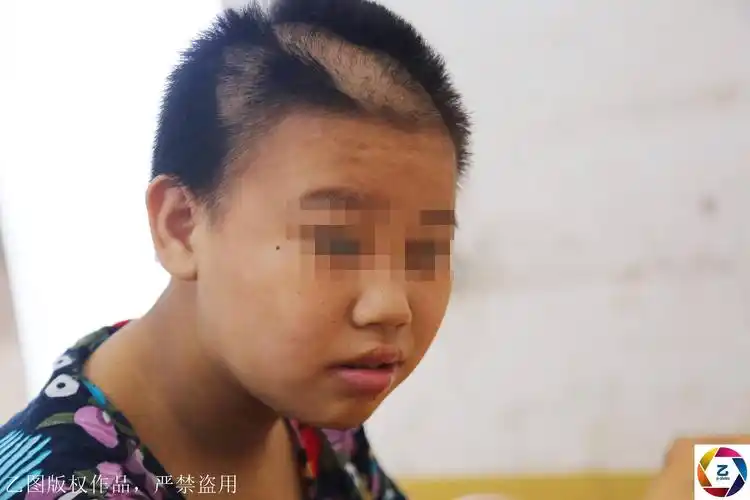 广东韶关十里亭镇,2006年出生的范世好(小名好好)今年只有13岁,智力一