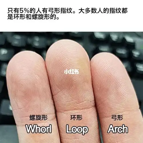 有弓形纹的小伙伴吗