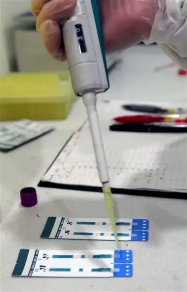 2月21日,在上海市长宁区疾控中心的"爱心小屋",医生利用hiv试纸进行