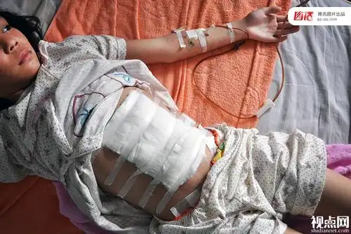图为2013年5月18日,湖南省常德市石门县人民医院,六年级住校生兰兰躺